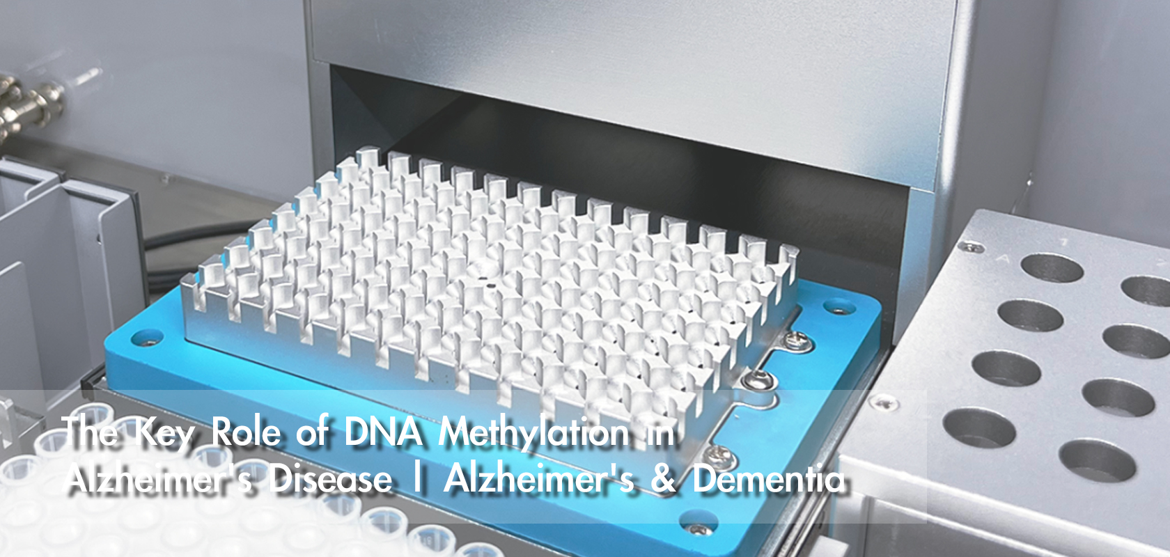 The Key Role of DNA Methylation in Alzheimer's Disease | Alzheimer's & Dementia